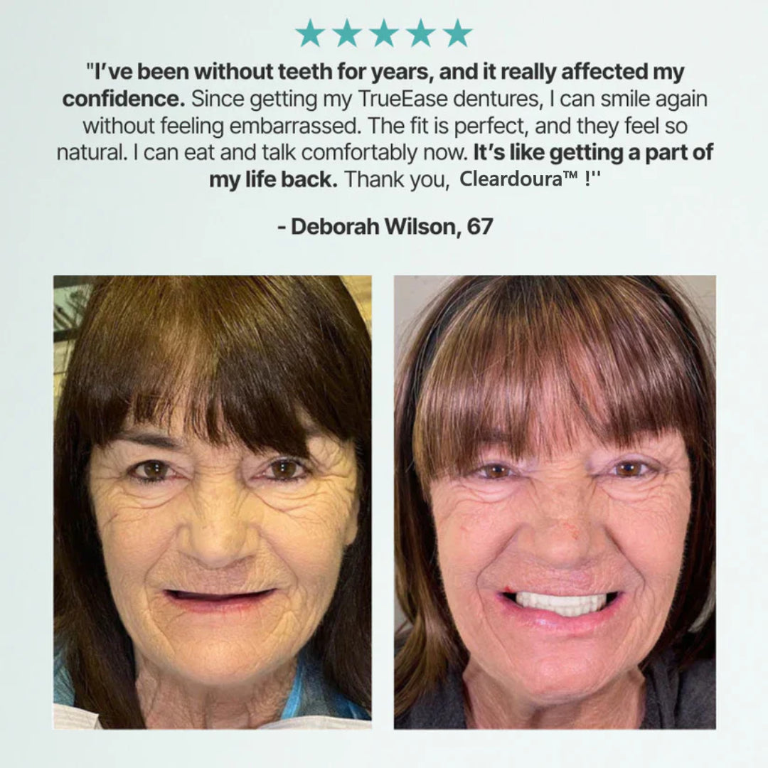 🌎Ends Today: 48% OFF! ⏰ Cleardoura™ Custom-Fit Full Functional DenturesMake you more confident (Brand-new upgraded packaging)