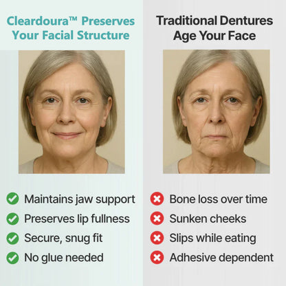 🌎Ends Today: 76% OFF! ⏰Cleardoura™ Medical Full Denture with Strong Suctiond🦷