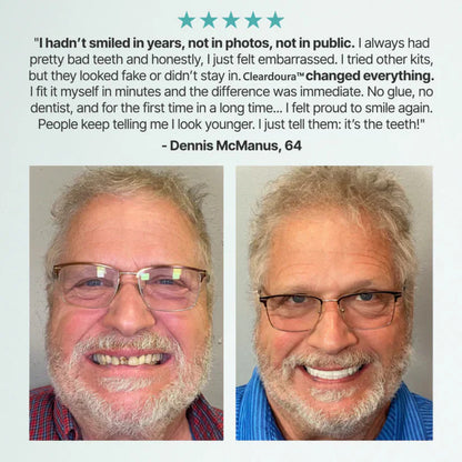 🌎Ends Today: 76% OFF! ⏰Cleardoura™ Medical Full Denture with Strong Suctiond🦷
